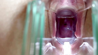 Stella St. Rose - Extreme Cervix Views and Juices Flowing Using a Speculum