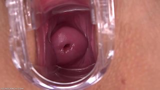 Candice Dare especulum