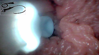 Exclusive: Camera Goes Inside - We Found My G-Spot and Captured 5 Orgasms!