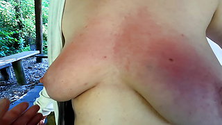 Red and swollen tits at bbq place