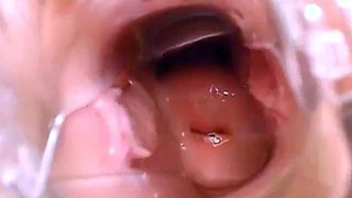 Webcam Pussy Play with Speculum
