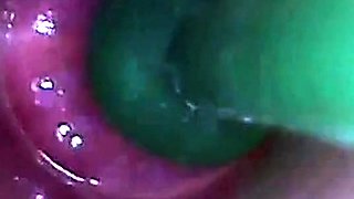 Endoscope POV Test Tube Cock Urethral Insertion