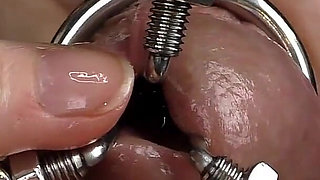 Dilation of the Hole Expanded Glans and Sperm Blockage Through Urethral Insertion of the Finger - Closeup