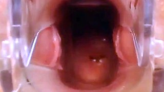 Webcam Pussy Play with Speculum