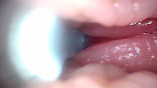First Time: an Endoscope Reveals the G-spot up Close - Without Mounting!