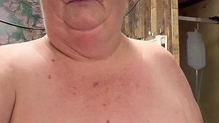 Bad Case of Shingles