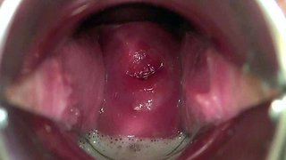 Amateur Asian Japanese Anal Creampie