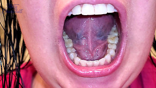 Mouth Tour with a Bottom Retainer